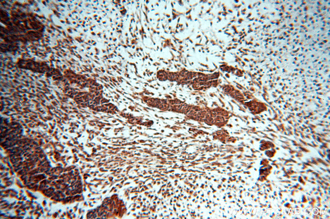 HDAC3 Antibody in Immunohistochemistry (Paraffin) (IHC (P))