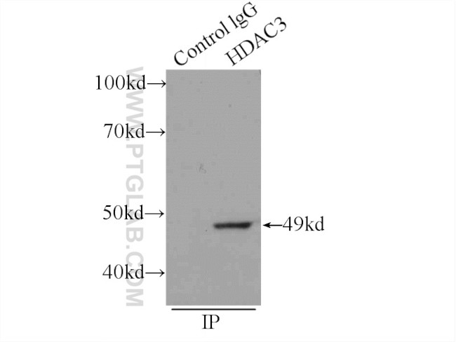 HDAC3 Antibody in Immunoprecipitation (IP)