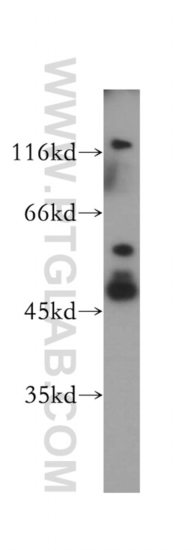 HDAC3 Antibody in Western Blot (WB)