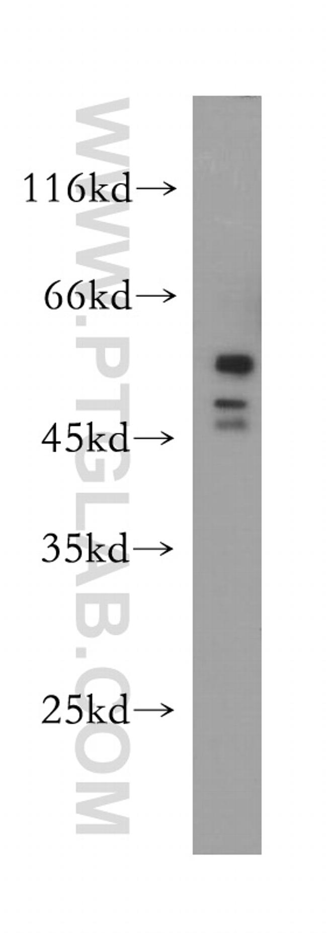 HDAC3 Antibody in Western Blot (WB)