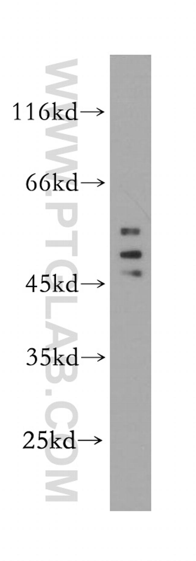 HDAC3 Antibody in Western Blot (WB)