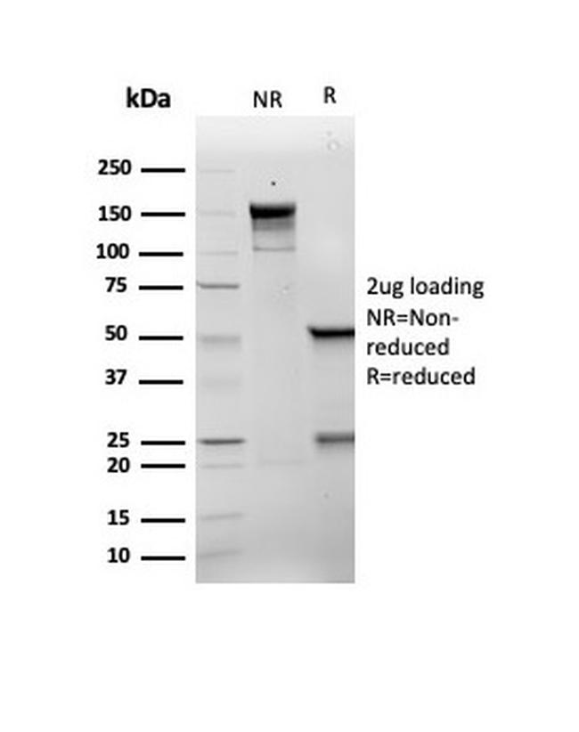 p21WAF1 (Tumor Suppressor Protein) Antibody in SDS-PAGE (SDS-PAGE)