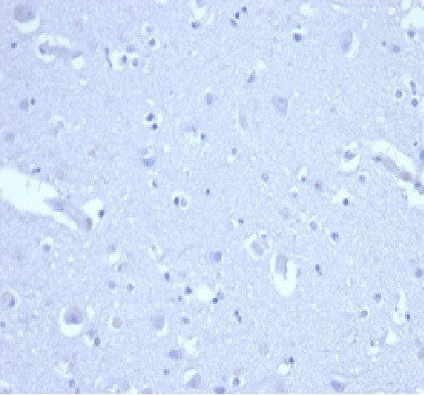 p21WAF1 (Tumor Suppressor Protein) Antibody in Immunohistochemistry (Paraffin) (IHC (P))