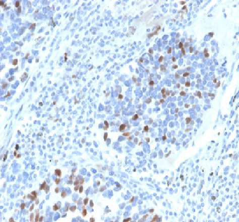 p21WAF1 (Tumor Suppressor Protein) Antibody in Immunohistochemistry (Paraffin) (IHC (P))