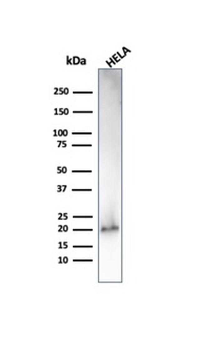 p21WAF1 (Tumor Suppressor Protein) Antibody in Western Blot (WB)