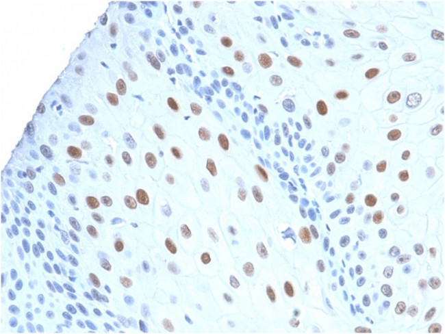 p21WAF1 (Tumor Suppressor Protein) Antibody in Immunohistochemistry (Paraffin) (IHC (P))