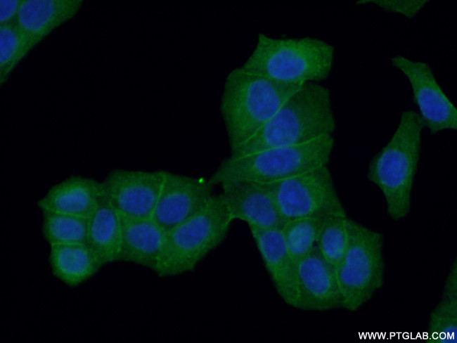 Drebrin Antibody in Immunocytochemistry (ICC/IF)