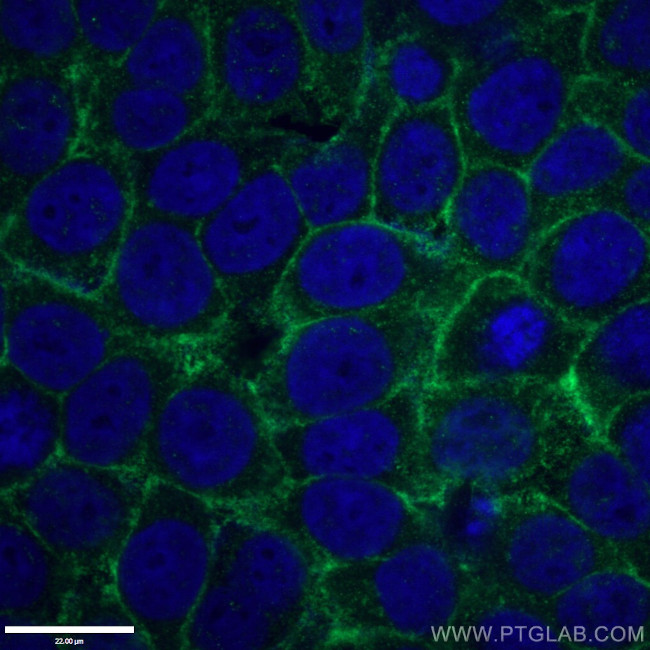 Drebrin Antibody in Immunocytochemistry (ICC/IF)