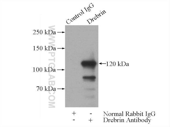 Drebrin Antibody in Immunoprecipitation (IP)