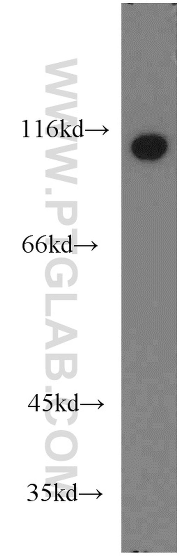 Drebrin Antibody in Western Blot (WB)