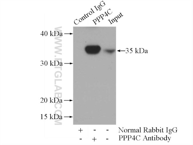 PPP4C Antibody in Immunoprecipitation (IP)