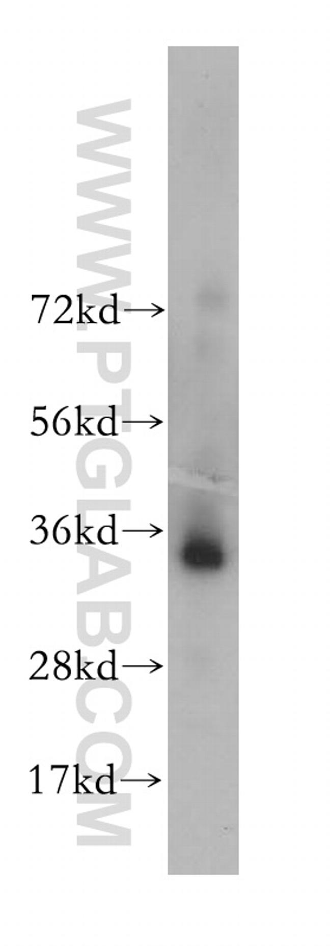 PPP4C Antibody in Western Blot (WB)