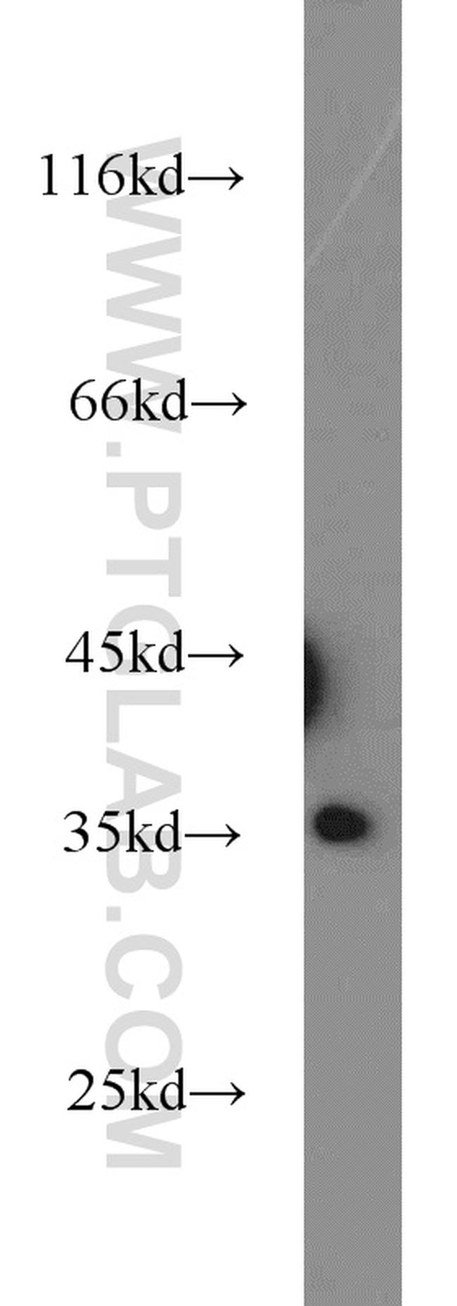 PPP4C Antibody in Western Blot (WB)