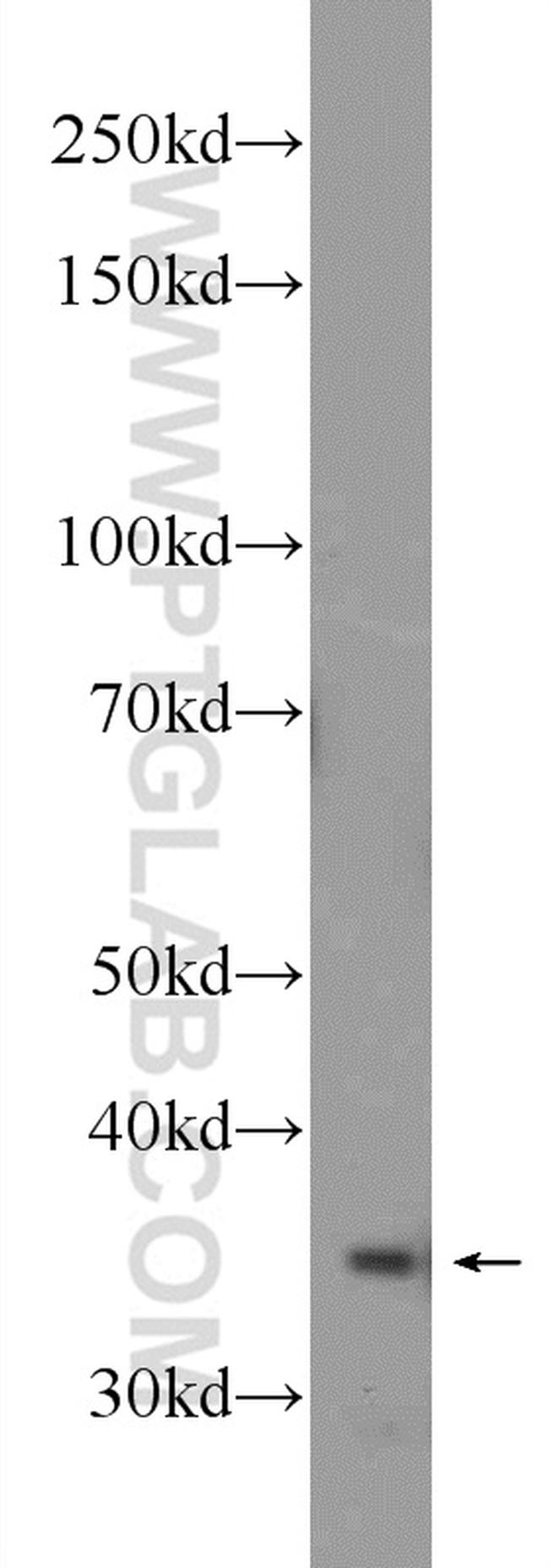 PPP4C Antibody in Western Blot (WB)