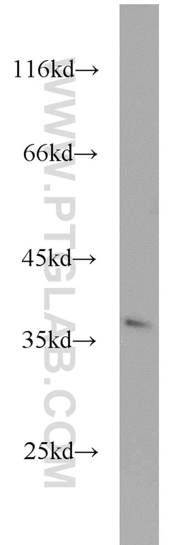 PIR Antibody in Western Blot (WB)