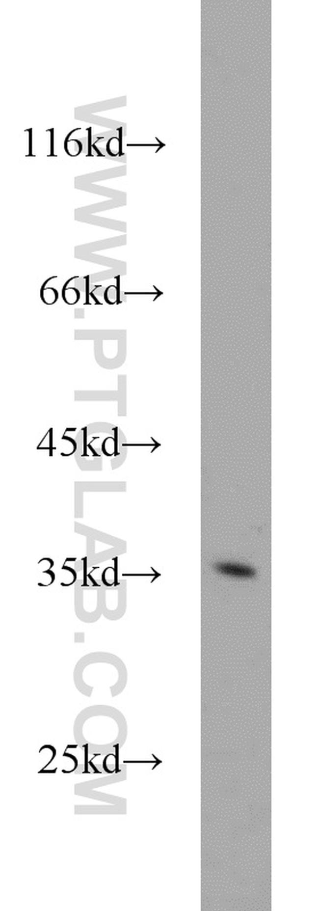 PIR Antibody in Western Blot (WB)