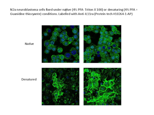 IL11RA Antibody in Immunocytochemistry (ICC/IF)