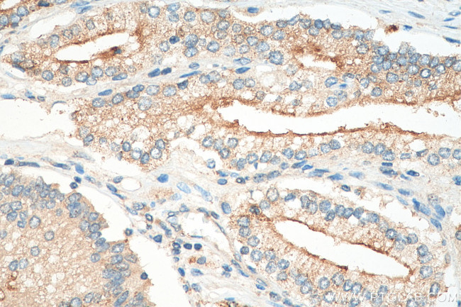 IL11RA Antibody in Immunohistochemistry (Paraffin) (IHC (P))