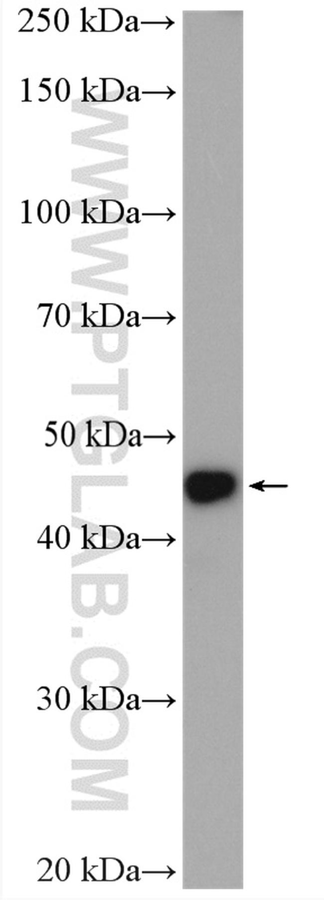 IL11RA Antibody in Western Blot (WB)