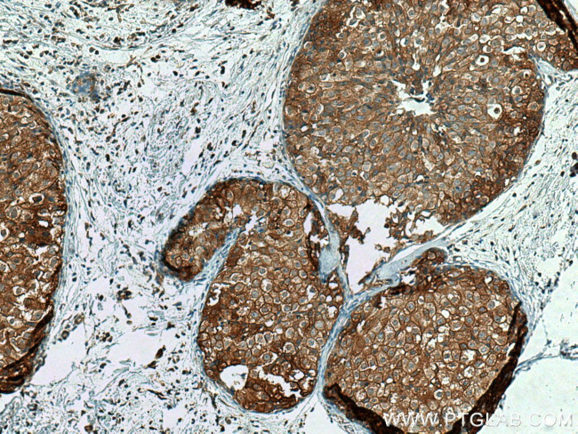 IFNGR2 Antibody in Immunohistochemistry (Paraffin) (IHC (P))