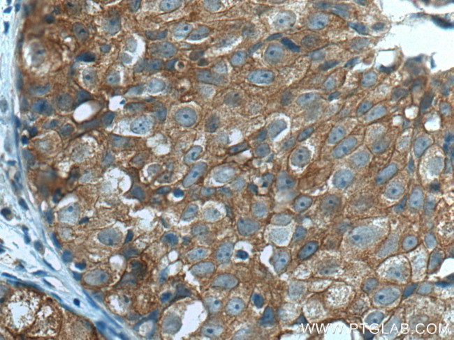 IFNGR2 Antibody in Immunohistochemistry (Paraffin) (IHC (P))