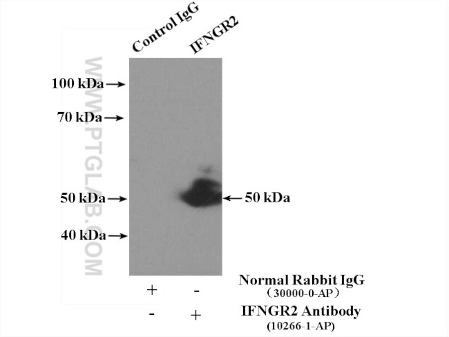 IFNGR2 Antibody in Immunoprecipitation (IP)