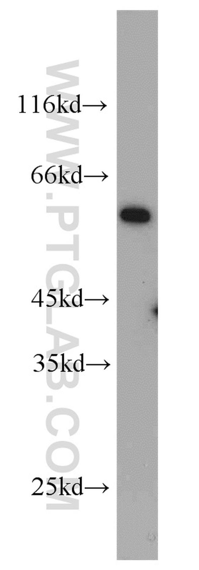 IFNGR2 Antibody in Western Blot (WB)