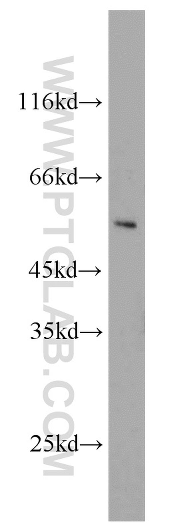 IFNGR2 Antibody in Western Blot (WB)