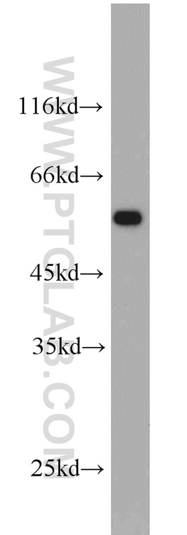 IFNGR2 Antibody in Western Blot (WB)