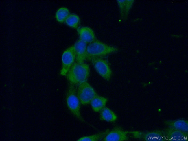 IkB alpha Antibody in Immunocytochemistry (ICC/IF)