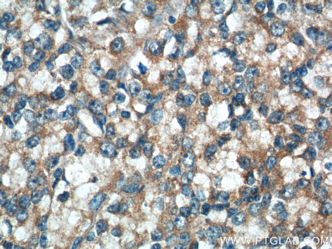 IkB alpha Antibody in Immunohistochemistry (Paraffin) (IHC (P))