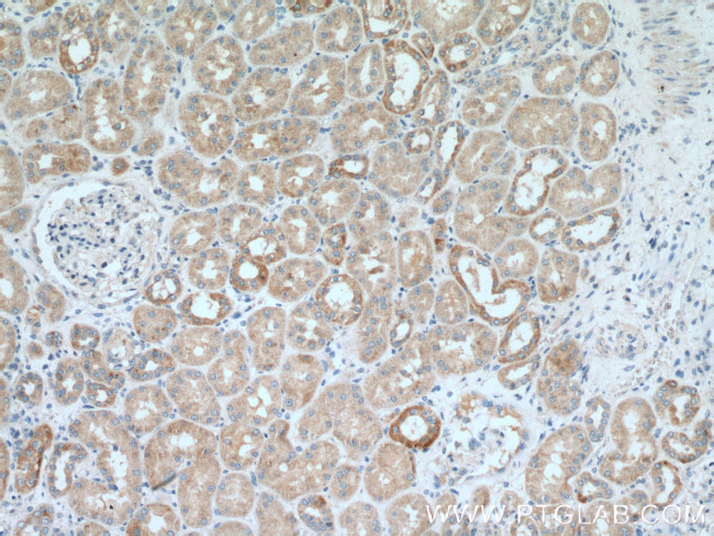 IkB alpha Antibody in Immunohistochemistry (Paraffin) (IHC (P))