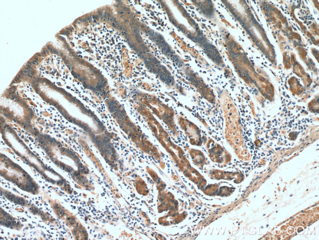 IkB alpha Antibody in Immunohistochemistry (Paraffin) (IHC (P))