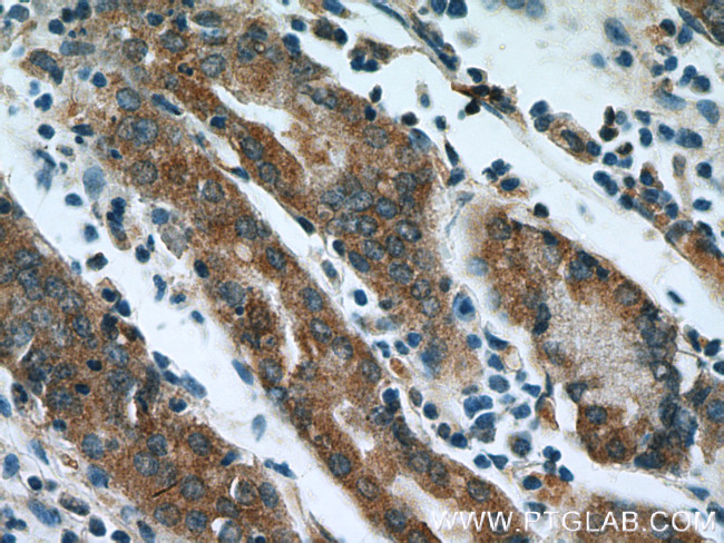 IkB alpha Antibody in Immunohistochemistry (Paraffin) (IHC (P))