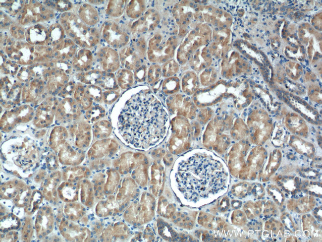 IkB alpha Antibody in Immunohistochemistry (Paraffin) (IHC (P))