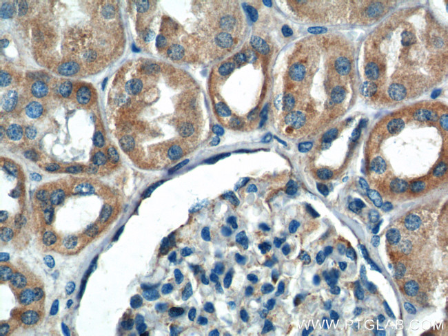 IkB alpha Antibody in Immunohistochemistry (Paraffin) (IHC (P))