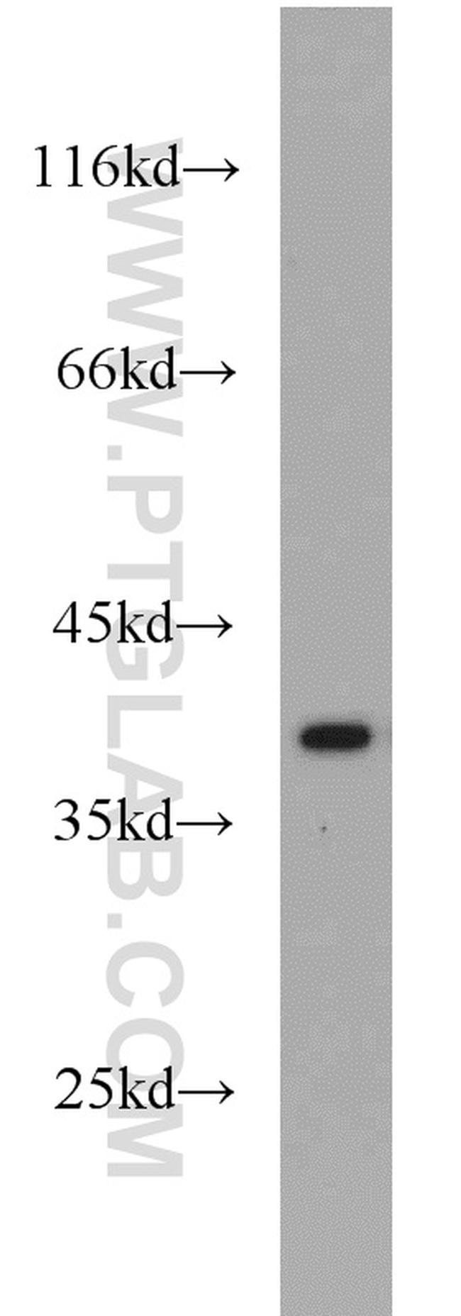 IkB alpha Antibody in Western Blot (WB)