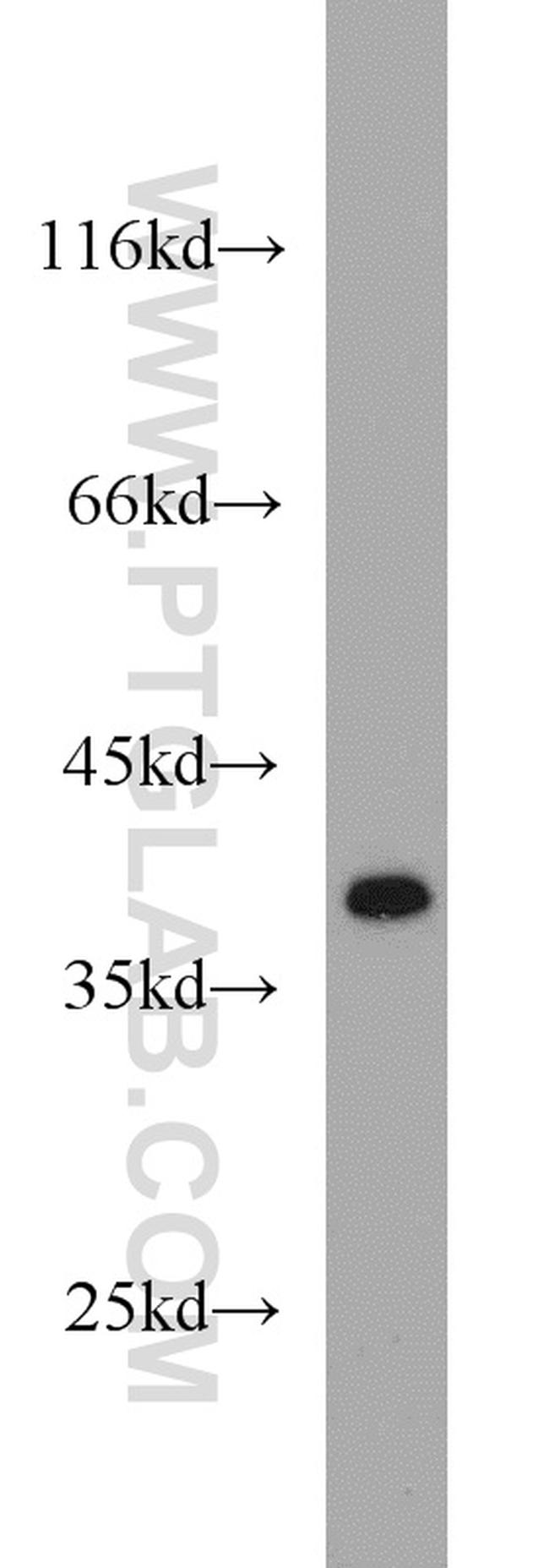 IkB alpha Antibody in Western Blot (WB)