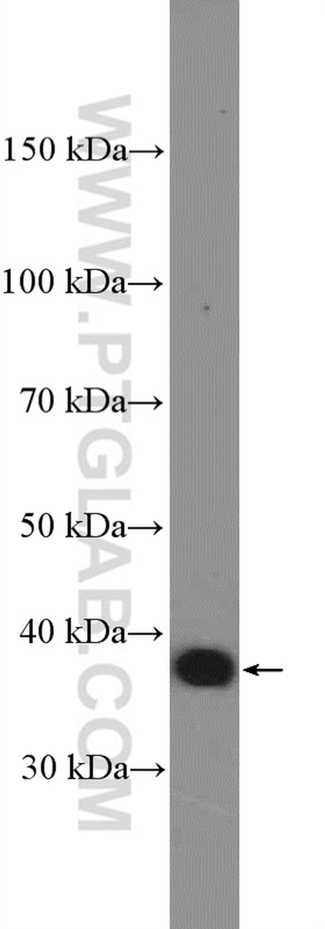 IkB alpha Antibody in Western Blot (WB)