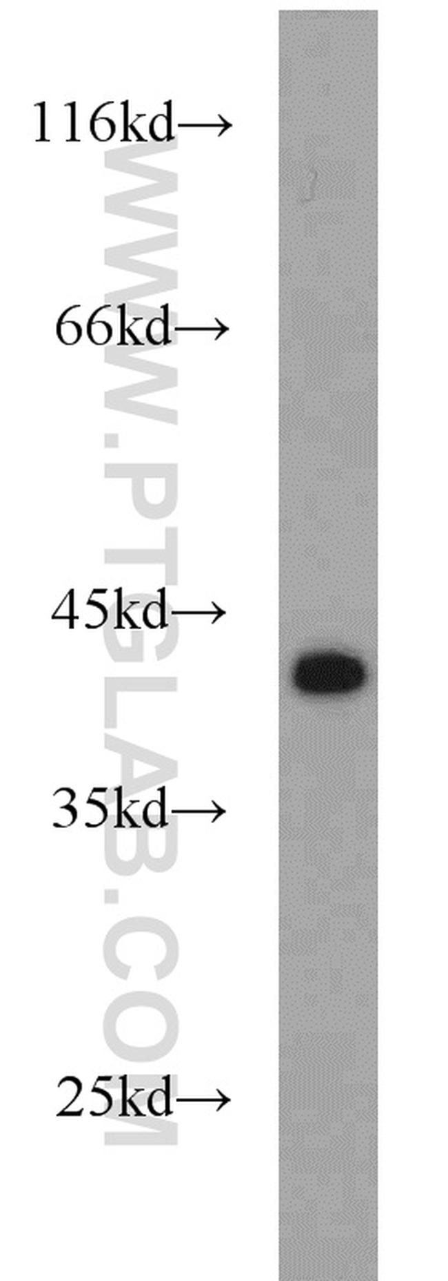 IkB alpha Antibody in Western Blot (WB)