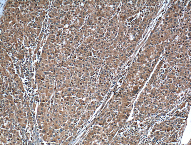 SOD1 Antibody in Immunohistochemistry (Paraffin) (IHC (P))