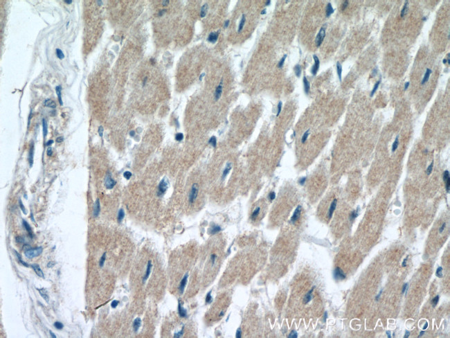 SOD1 Antibody in Immunohistochemistry (Paraffin) (IHC (P))