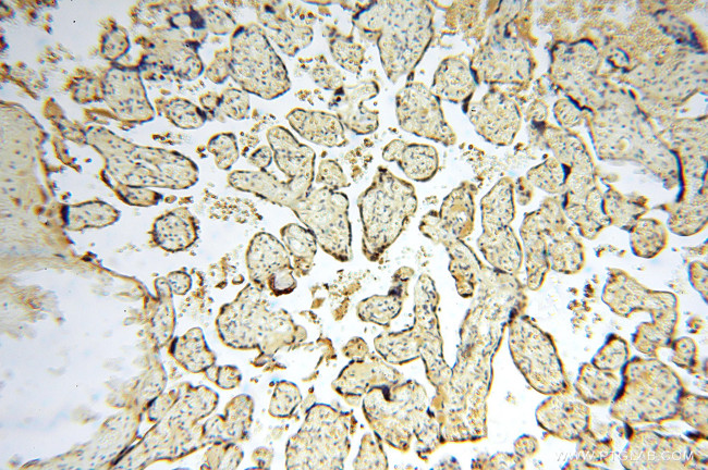 SOD1 Antibody in Immunohistochemistry (Paraffin) (IHC (P))