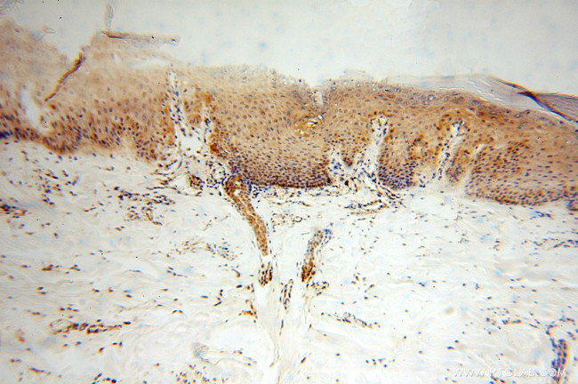 SOD1 Antibody in Immunohistochemistry (Paraffin) (IHC (P))