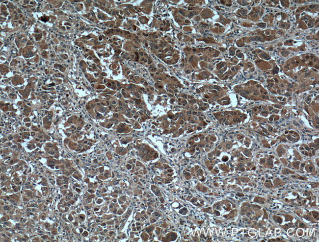 SOD1 Antibody in Immunohistochemistry (Paraffin) (IHC (P))