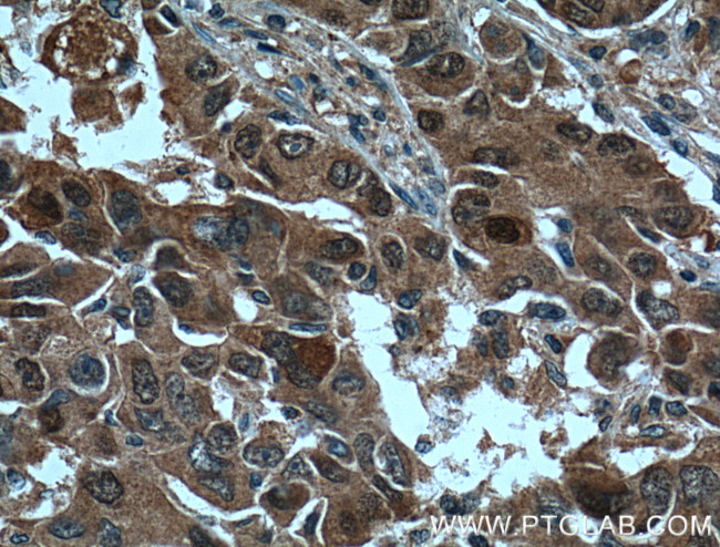 SOD1 Antibody in Immunohistochemistry (Paraffin) (IHC (P))