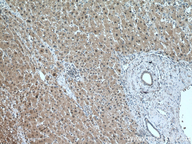 SOD1 Antibody in Immunohistochemistry (Paraffin) (IHC (P))