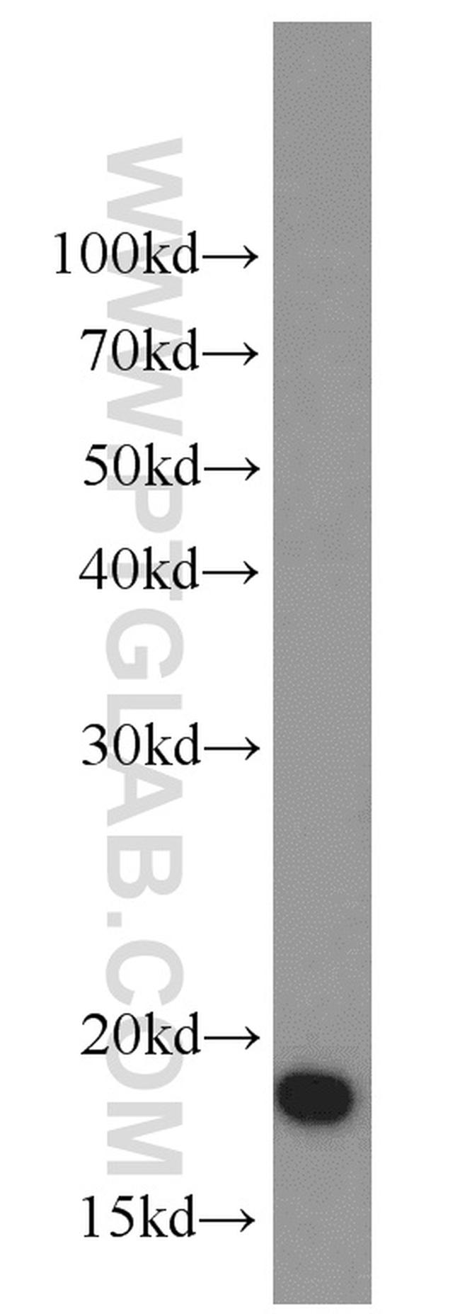 SOD1 Antibody in Western Blot (WB)