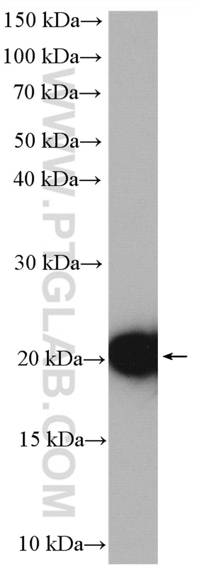 SOD1 Antibody in Western Blot (WB)