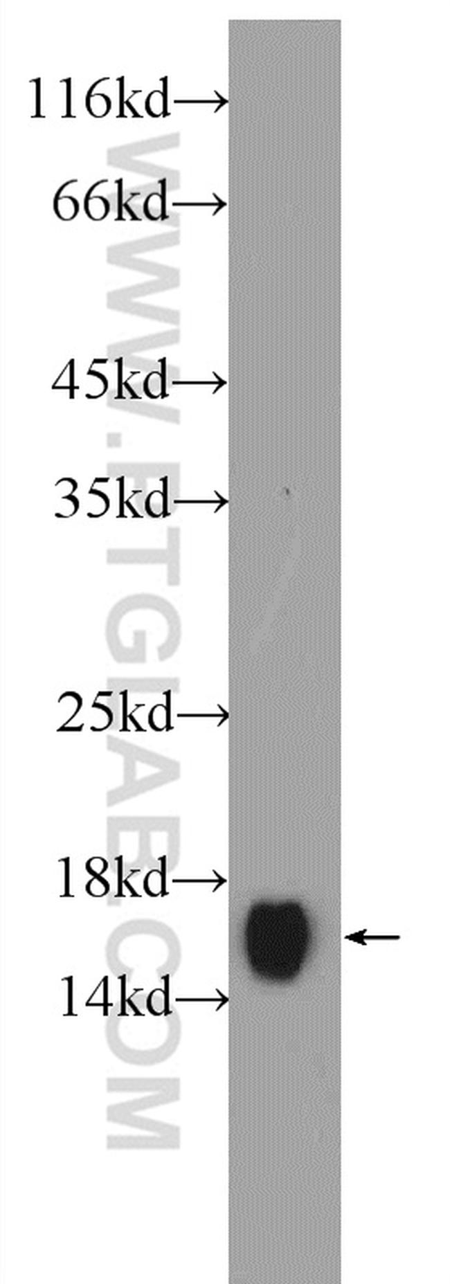 SOD1 Antibody in Western Blot (WB)